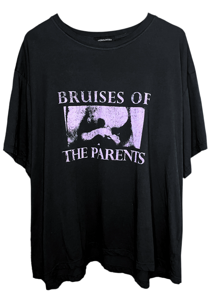 ‘Bruises' T-Shirt