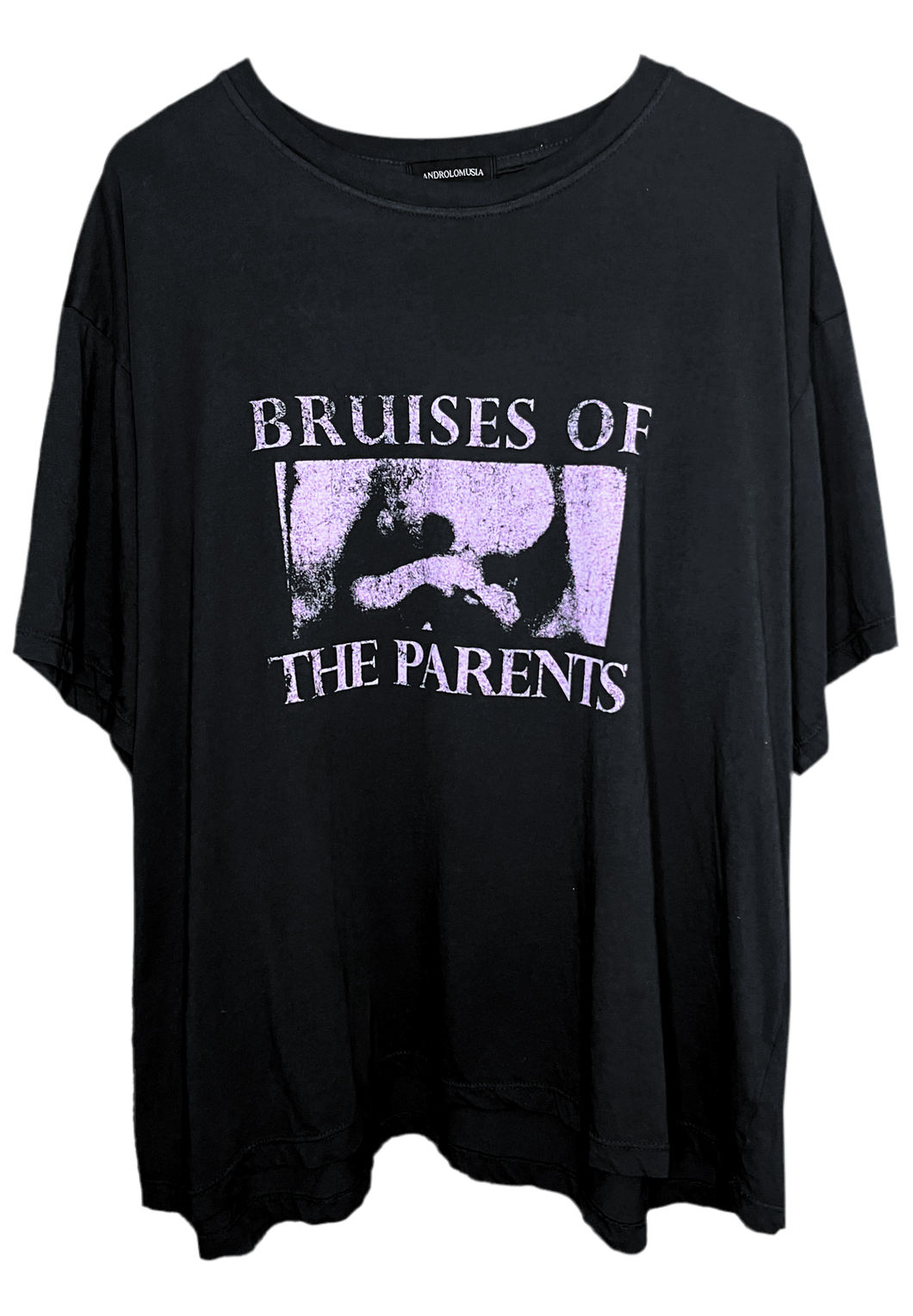 ‘Bruises' T-Shirt