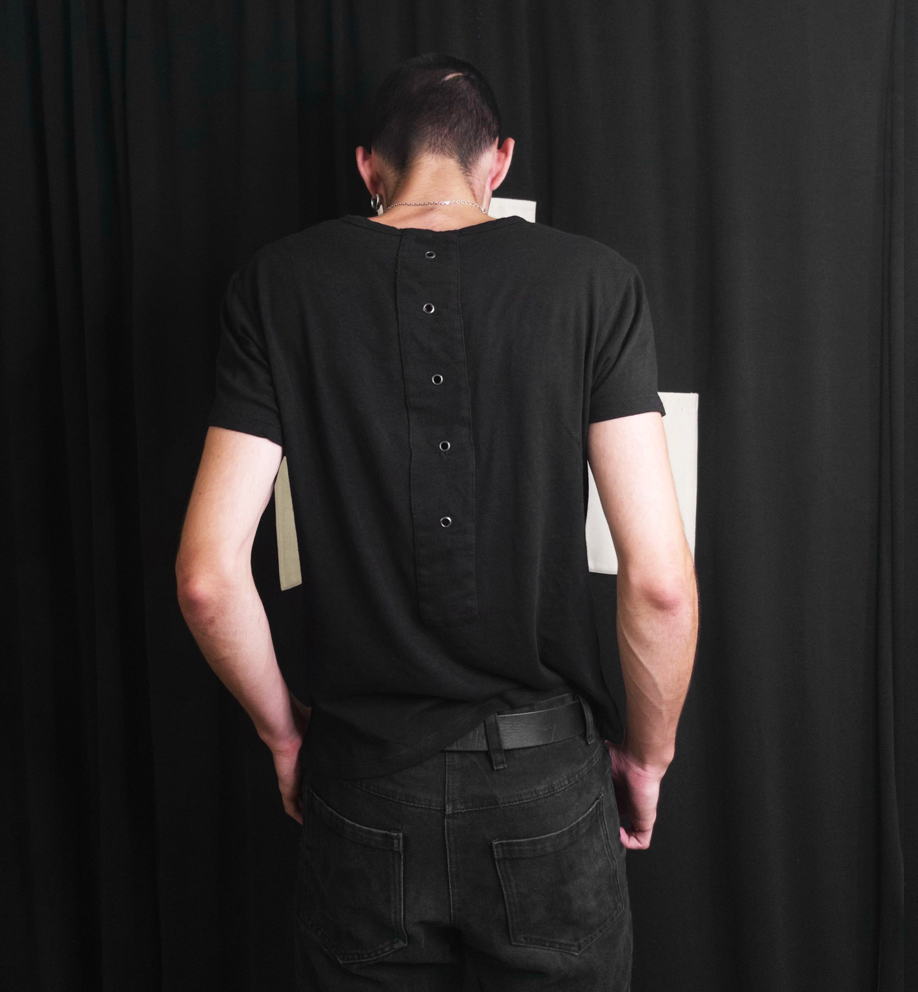 SCOLIOSIS